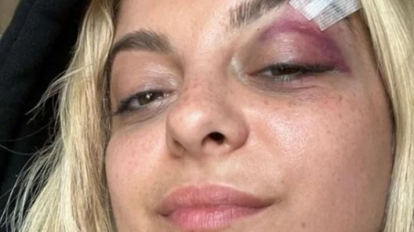 Qëlloi me telefon Bebe Rexhën, 27-vjeçari: M’u duk argëtuese