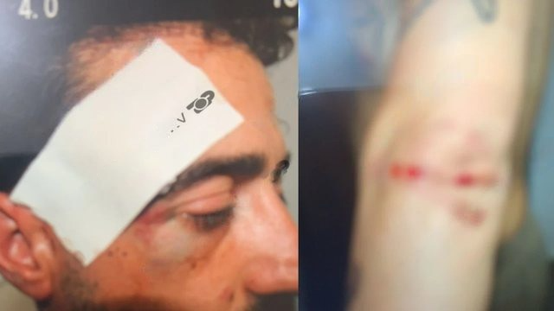 Rrahën të dashurin e vajzës brenda në spital, Gjykata e Durrësit cakton masën ‘arrest në burg’ për babain dhe dy të afërmit e tij