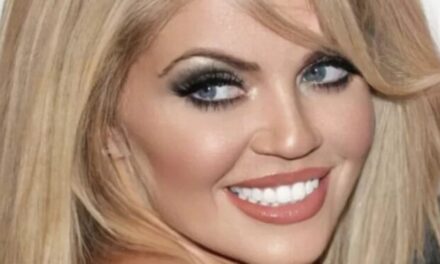 Nga ëndrra e çdo mashkulli në një “makth” prej operacioneve plastike! Shikoni si është transformuar aktorja e njohur