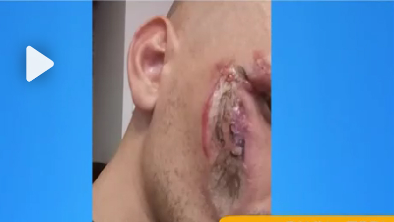 Celulari ka “shpërthyer” teksa pronari i tij ishte duke fjetur