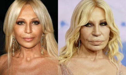 Donatella Versace nuk njihet më pas operacionit plastik!