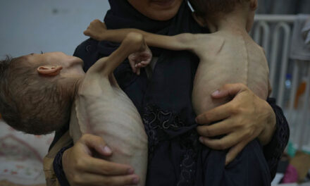 Studim tronditës mbi Gazën: Një në gjashtë fëmijë vuan nga kequshqyerja ekstreme akute